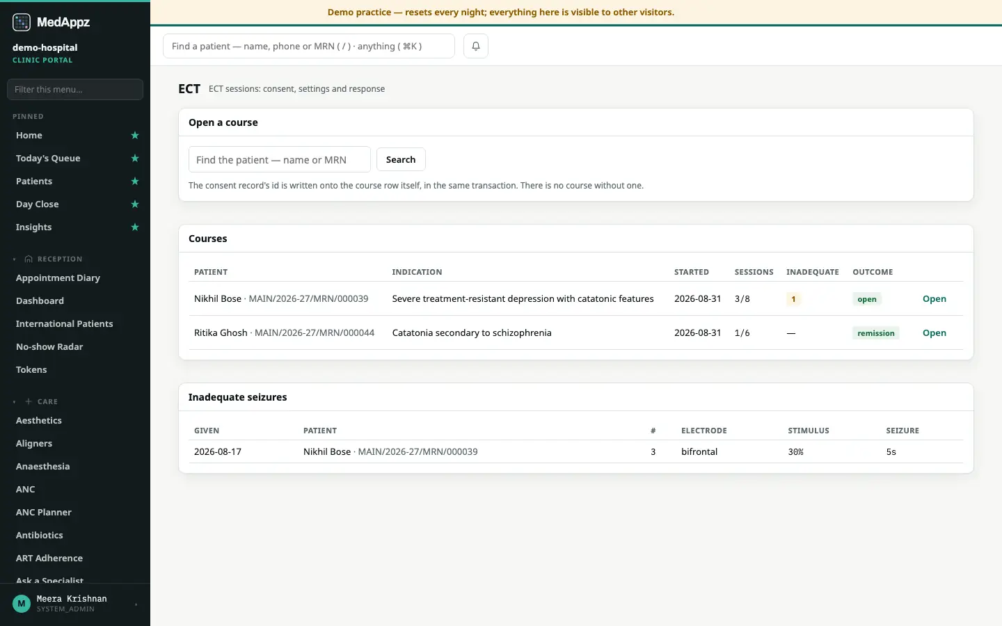 ECTLog — ECT — ECT sessions: consent, settings and response